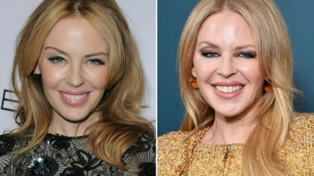 Kylie Minogue’s Plastic Surgery Before and After Celebrity Jihad